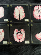 *Modern* Glass Anatomical Brain Slide Set of 10 Coasters