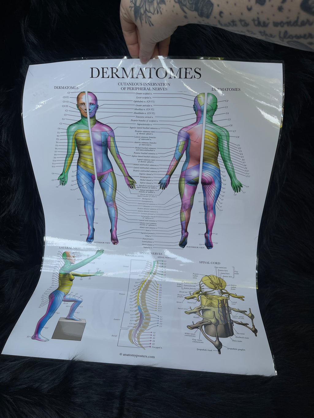 *Modern* Laminated Double Sided Anatomy & Injuries of the Hip / Dermatomes Poster