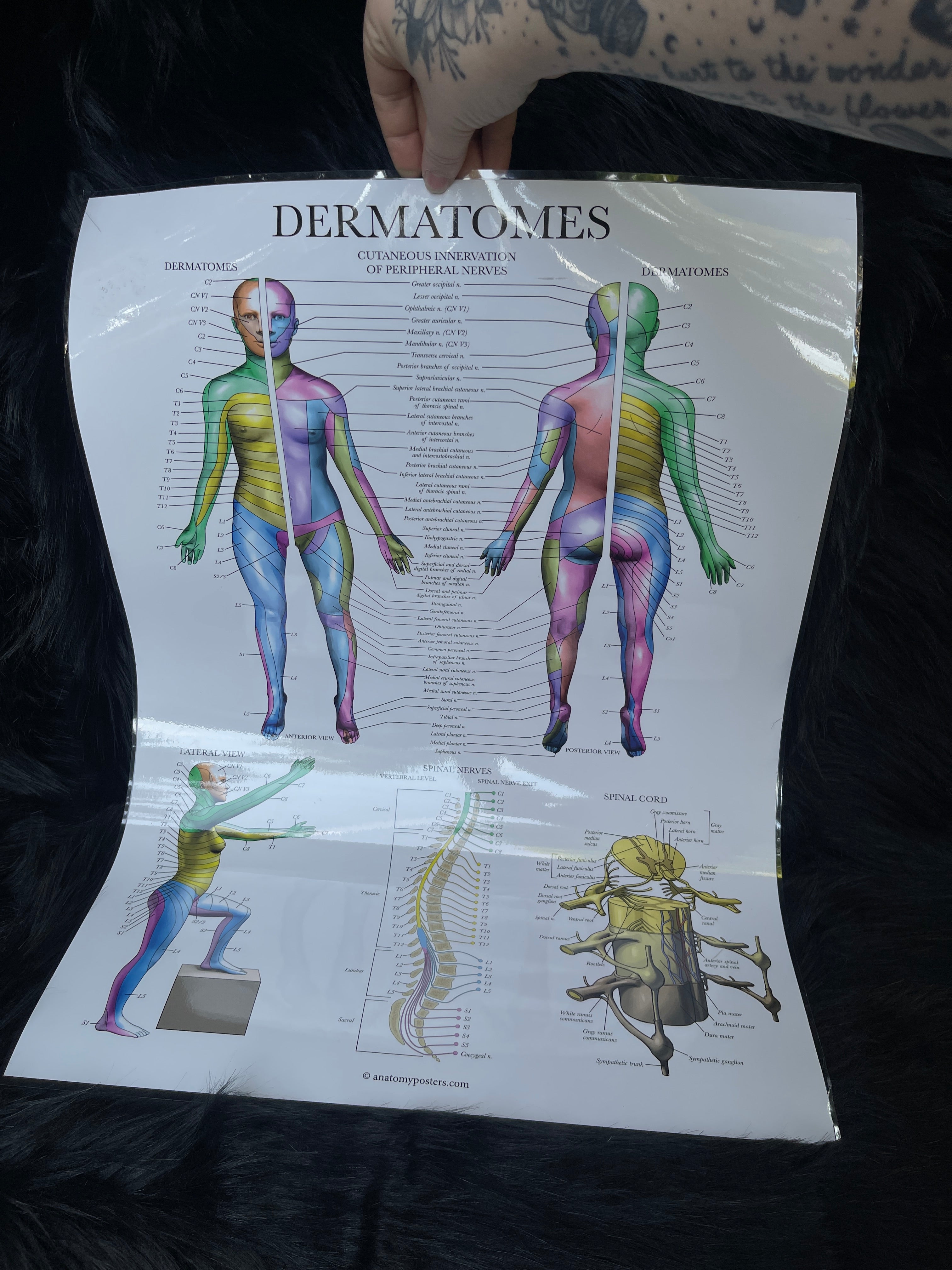 *Modern* Laminated Double Sided Anatomy & Injuries of the Hip / Dermatomes Poster